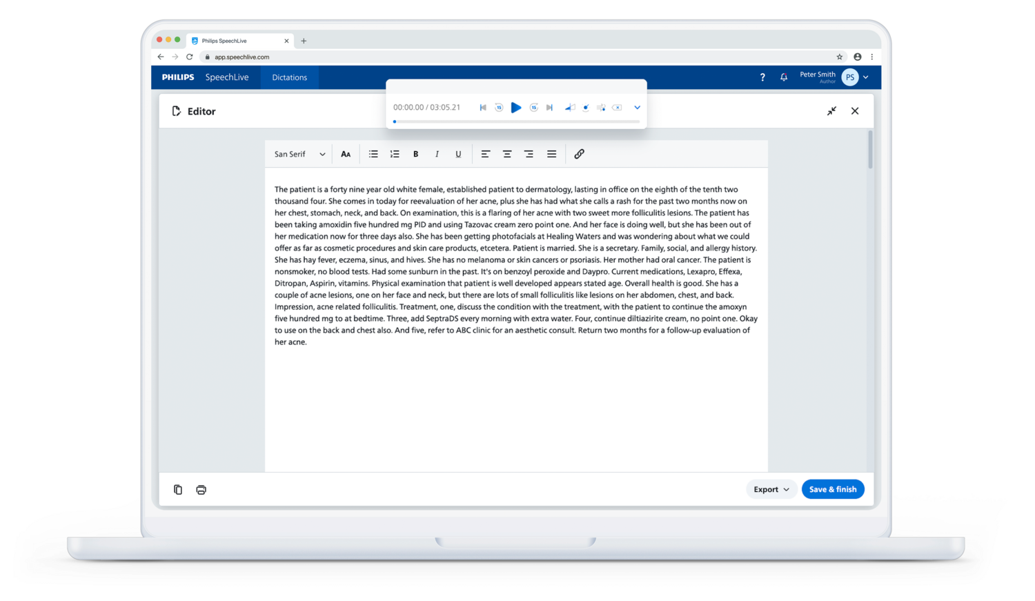 Edit the transcribe text in the SpeechLive editor with original dictation audio